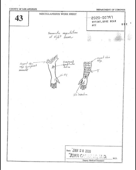 kobe autopsy|LA County Coroner releases autopsy reports for。